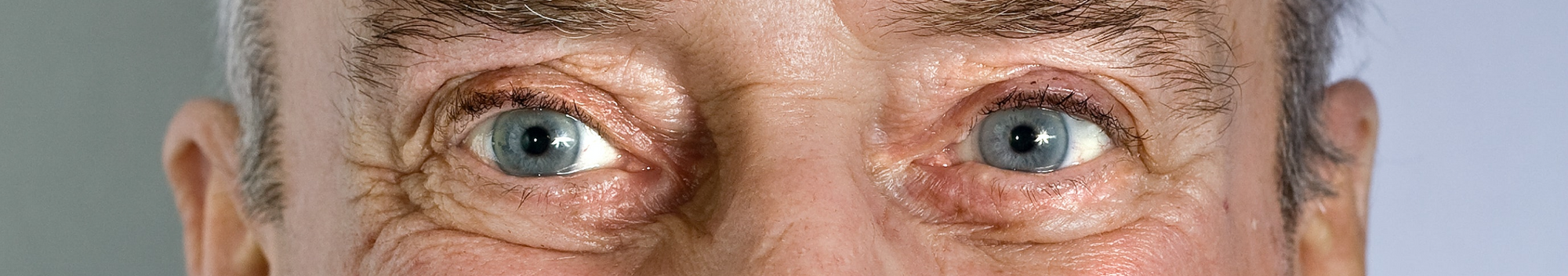 Eye Health